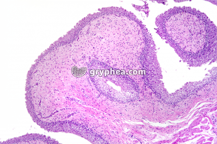 Valvule intestinale x25 - gryphea.org